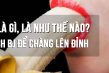 Bj, Hj Là Gì