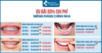 Bảng giá Thiết bị chỉnh nha Nha khoa Sài Gòn