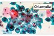 bệnh chlamydia, hình ảnh bệnh chlamydia, bệnh chlamydia có chữa khỏi được không, bệnh chlamydia ở nam giới, bệnh chlamydia o nam gioi, thời gian ủ bệnh chlamydia, thuốc chữa bệnh chlamydia, chlamydia, chlamydia treatment, chlamydia symptoms, symptoms of chlamydia, chlamydia how to treat