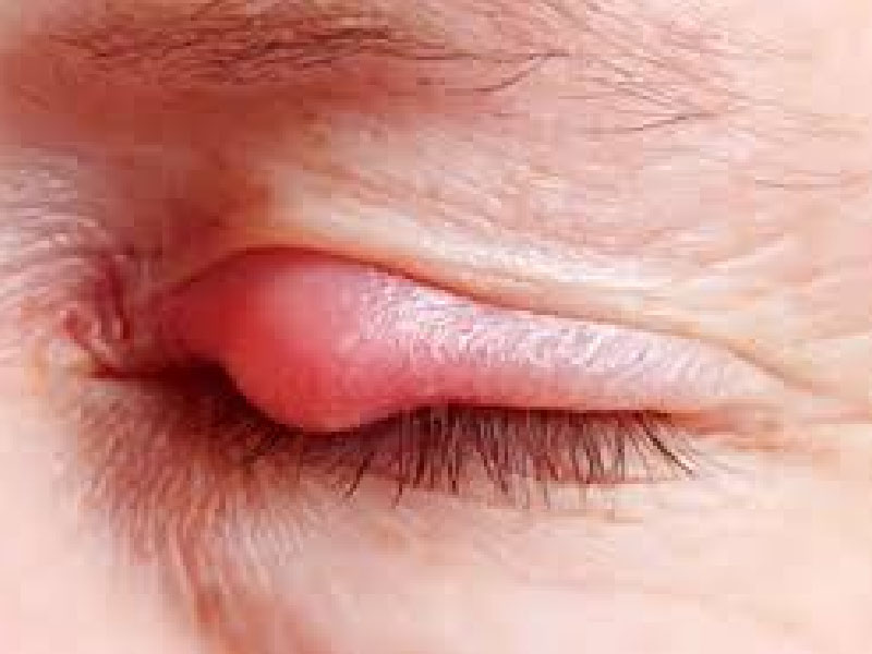 10 bệnh về mắt nguy hiểm phổ biến nhất mà mọi người nên biết