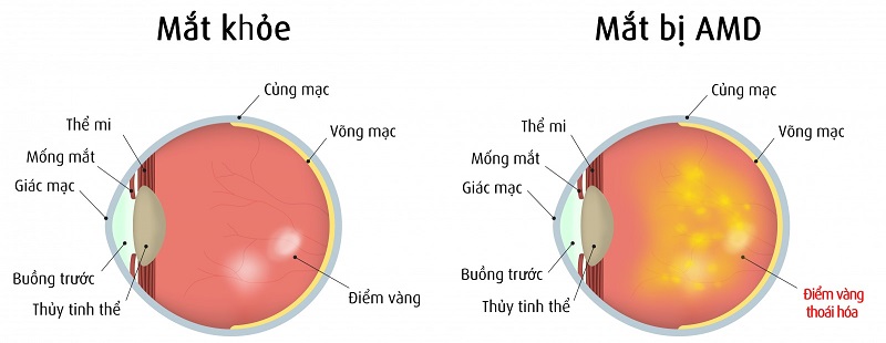 10 bệnh về mắt nguy hiểm phổ biến nhất mà mọi người nên biết