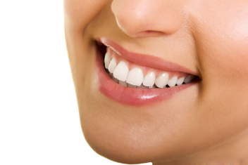 Bọc răng sứ là giải pháp để có nụ cười tự tin với hàm răng trắng sáng