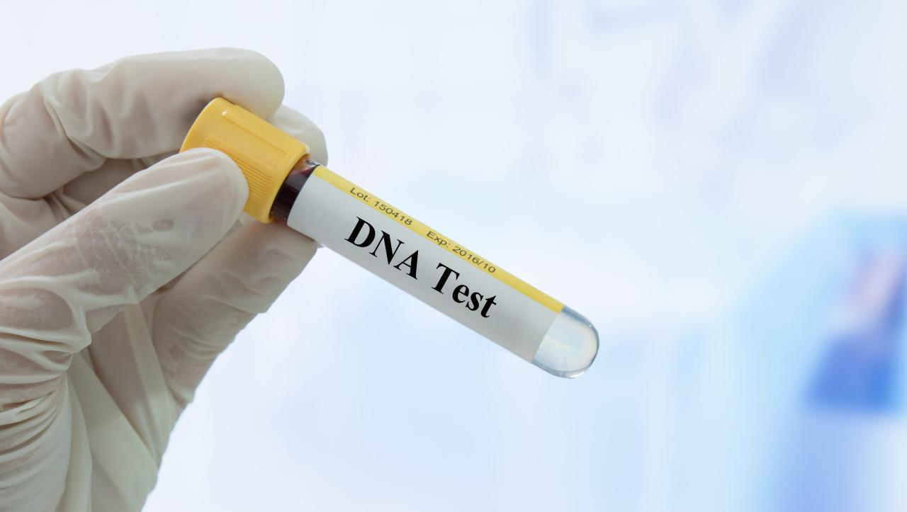Five things you need to know before you take a home DNA test