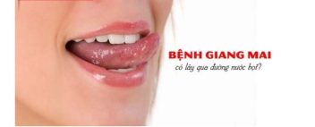 bệnh giang mai ở miệng, hình ảnh bệnh giang mai ở miệng, bệnh giang mai, giang mai, bệnh giang mai là gì, bệnh giang mai la gi, bệnh giang mai ở nữ, bệnh giang mai có chữa được không, bệnh giang mai lây qua đường nào, bệnh giang mai có ngứa không, bệnh giang mai là bệnh gì, thời gian ủ bệnh giang mai