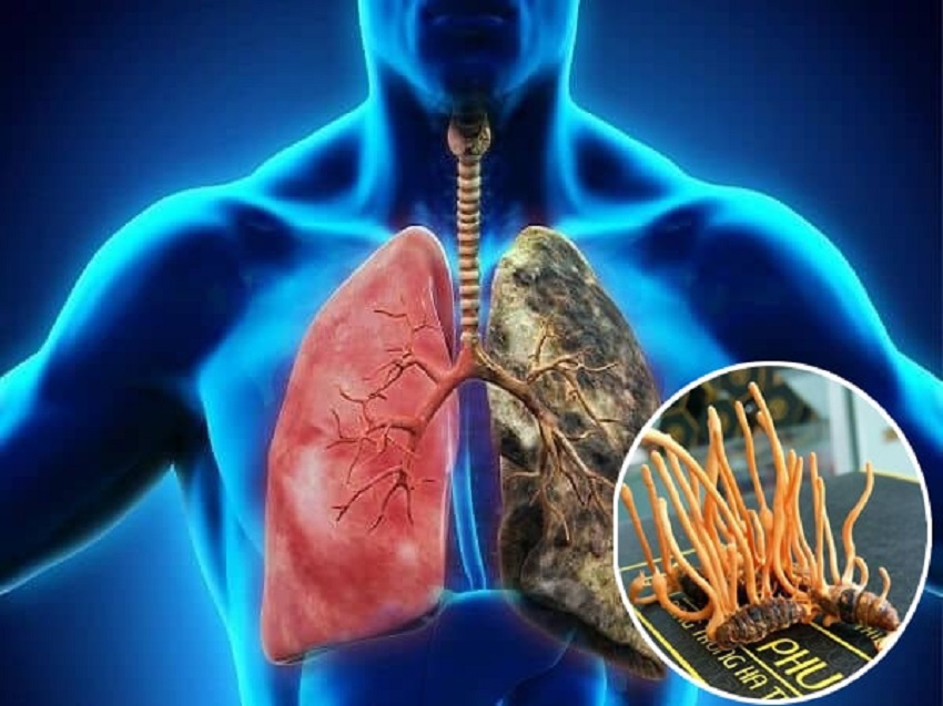 Ung thư phổi có uống được đông trùng hạ thảo không?